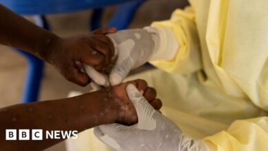 First case of more contagious mpox detected outside Africa