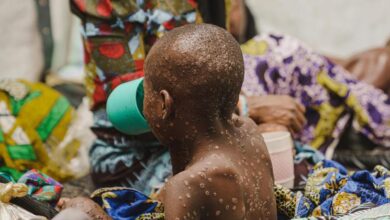 Mpox: Equitable vaccine access is crucial for the Global South