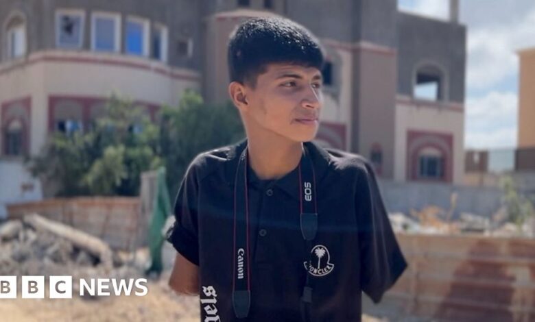 Amputees in Gaza are provided with easy-to-install prosthetic limbs using British technology